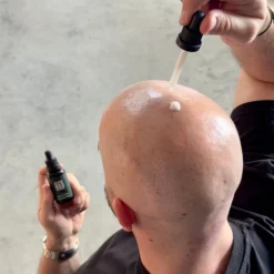 Anti-Pigmentoiva Kaljuseerumi